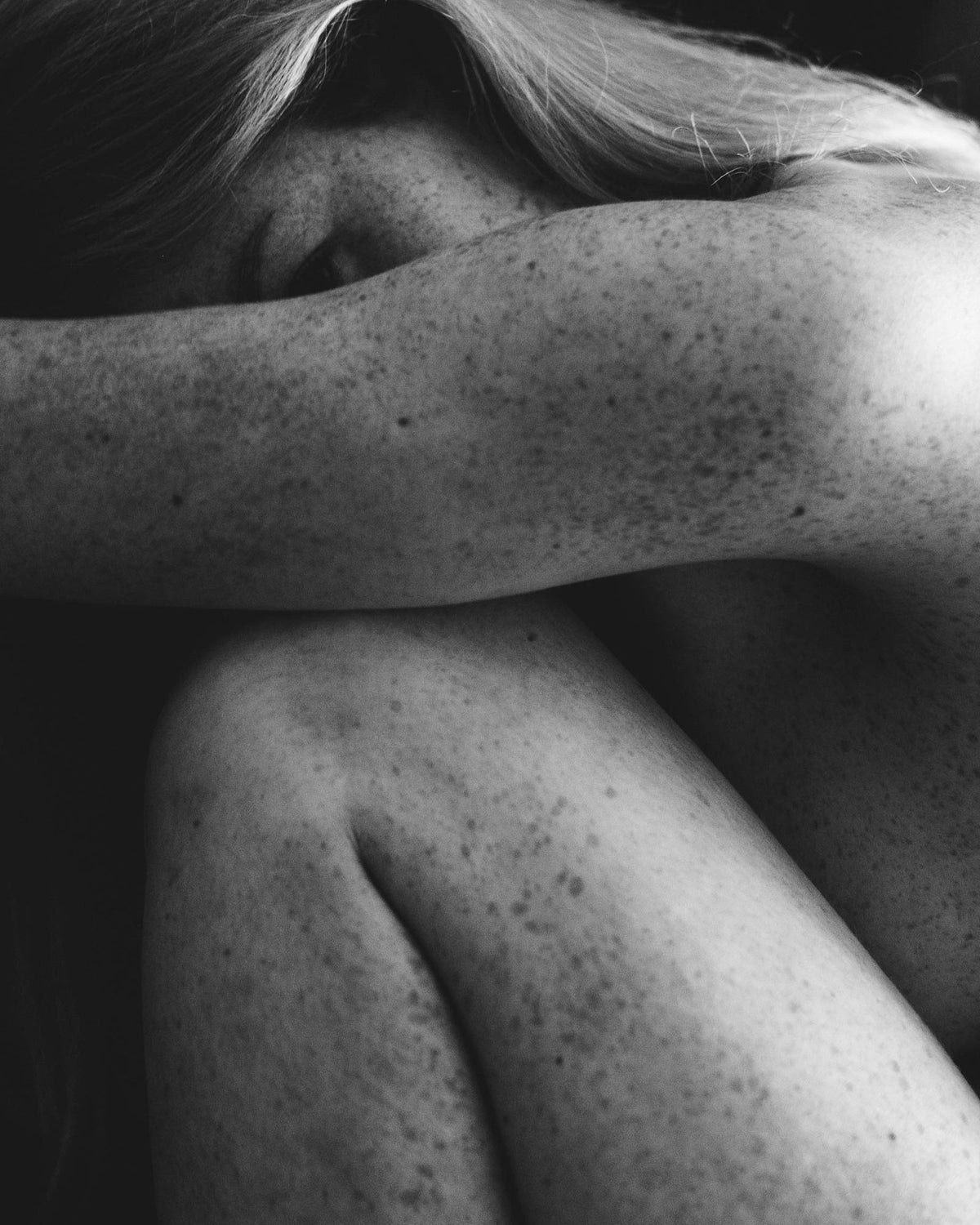 A close-up, black and white photograph of a pale-skinned, freckled woman sitting with her knees to her chest and her left arm straightened forward.